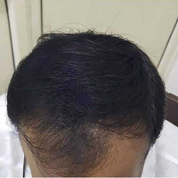 Haarspray mit mikrofasern | HAIRBUILD